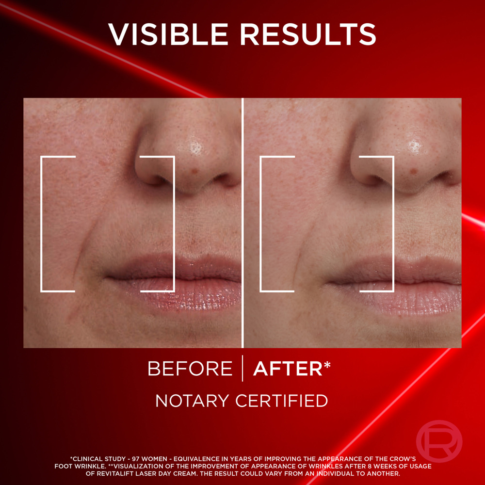 Revitalift Laser Day Cream