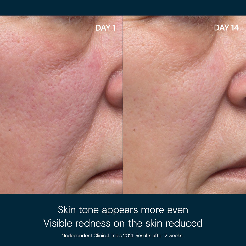 Dynamic Resurfacing Facial Pads, 60-Pack