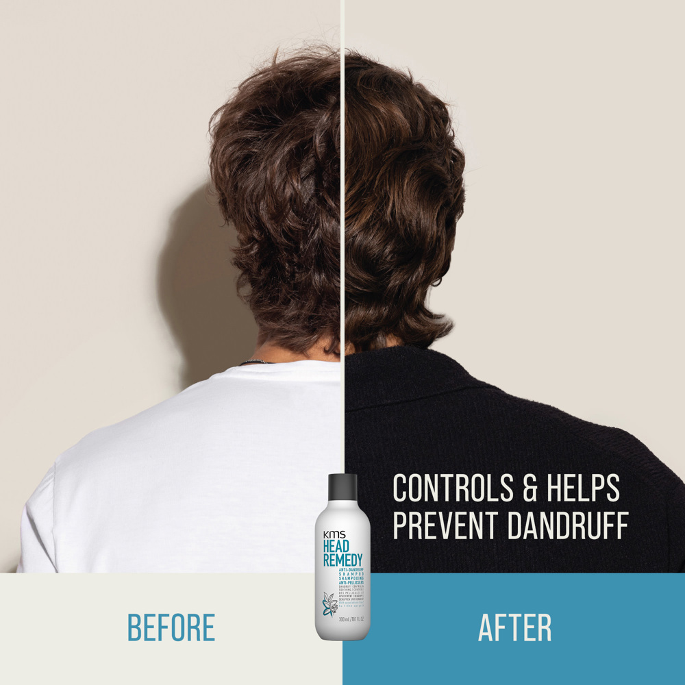Headremedy Anti-Dandruff Shampoo