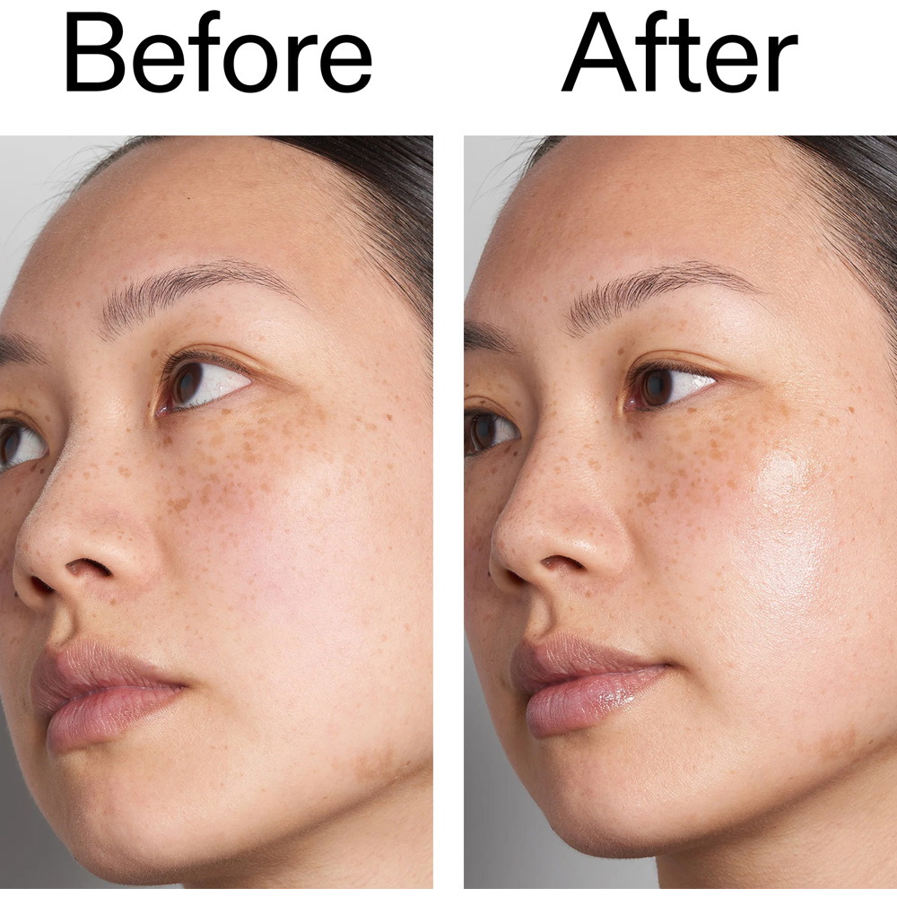 Hyaluronic Acid Serum