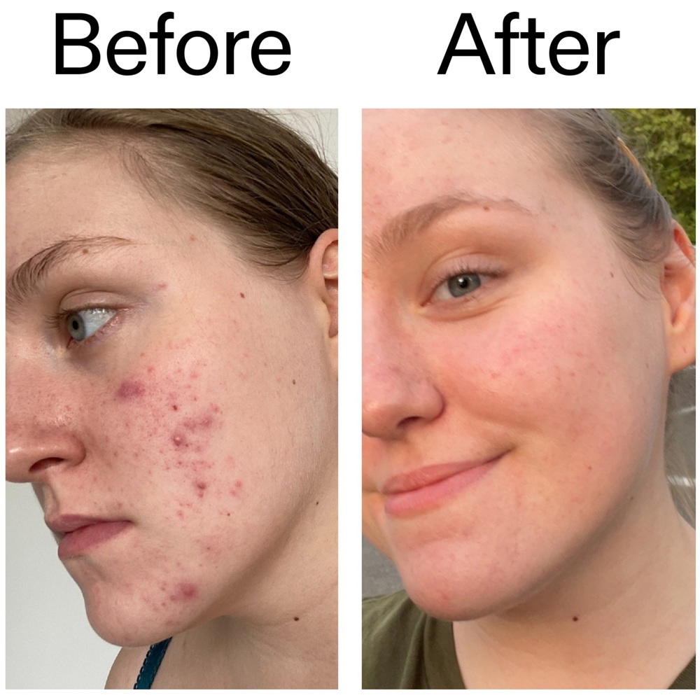 Glycolic Acid Toner, 100ml