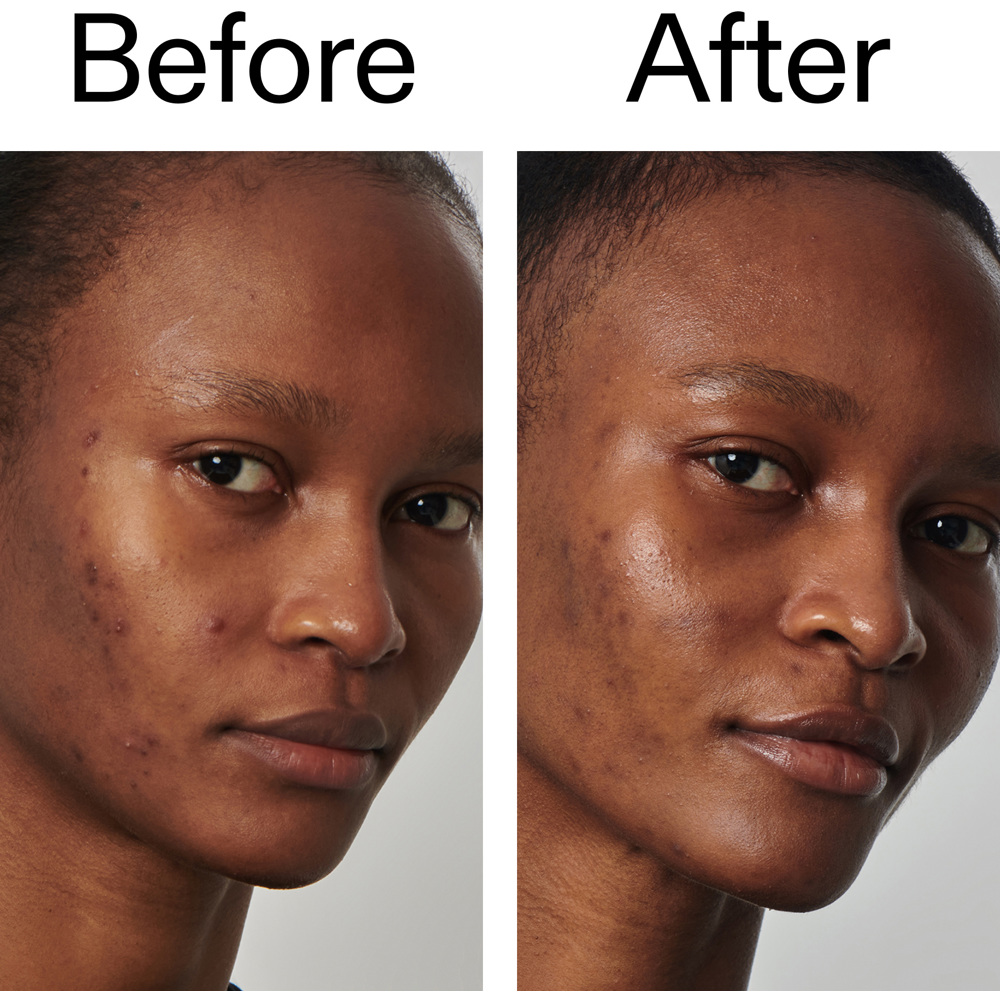 Niacinamide Serum, 30ml