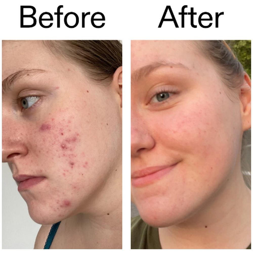 15% Vitamin C and EGF Serum, 30ml