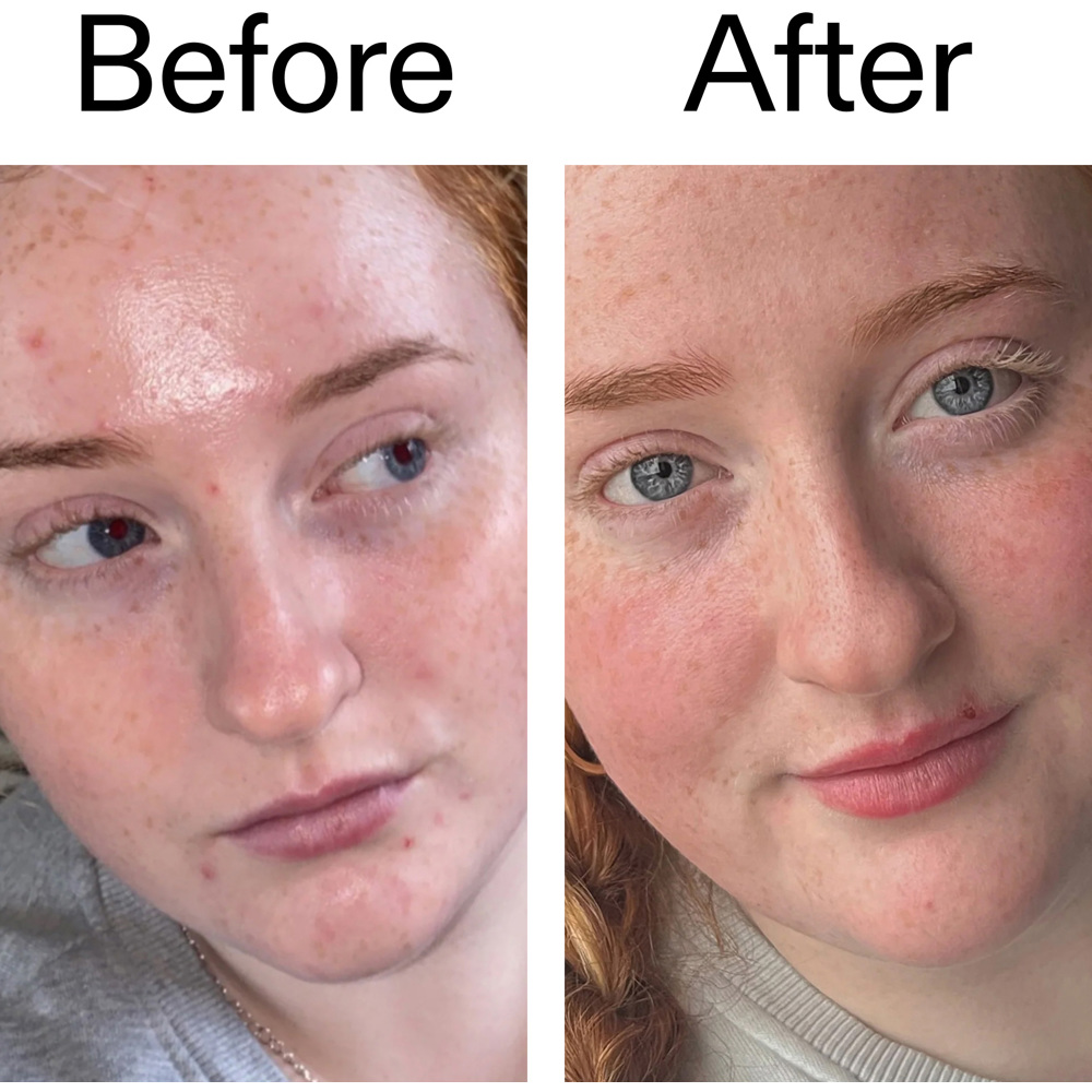 Vitamin B, C and E Moisturizer, 50ml