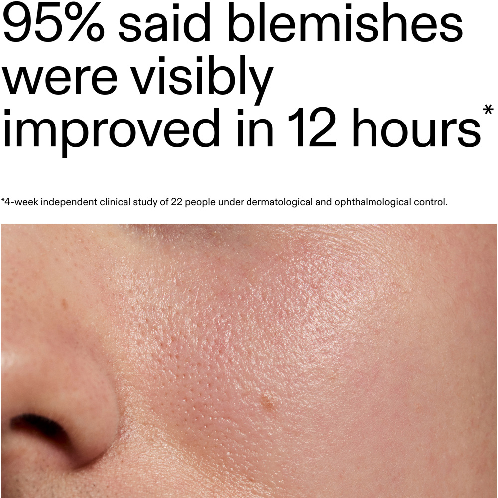 Succinic Acid Treatment, 15ml