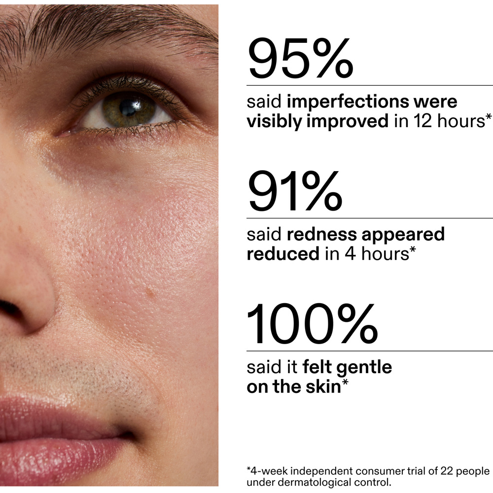 Succinic Acid Treatment, 15ml