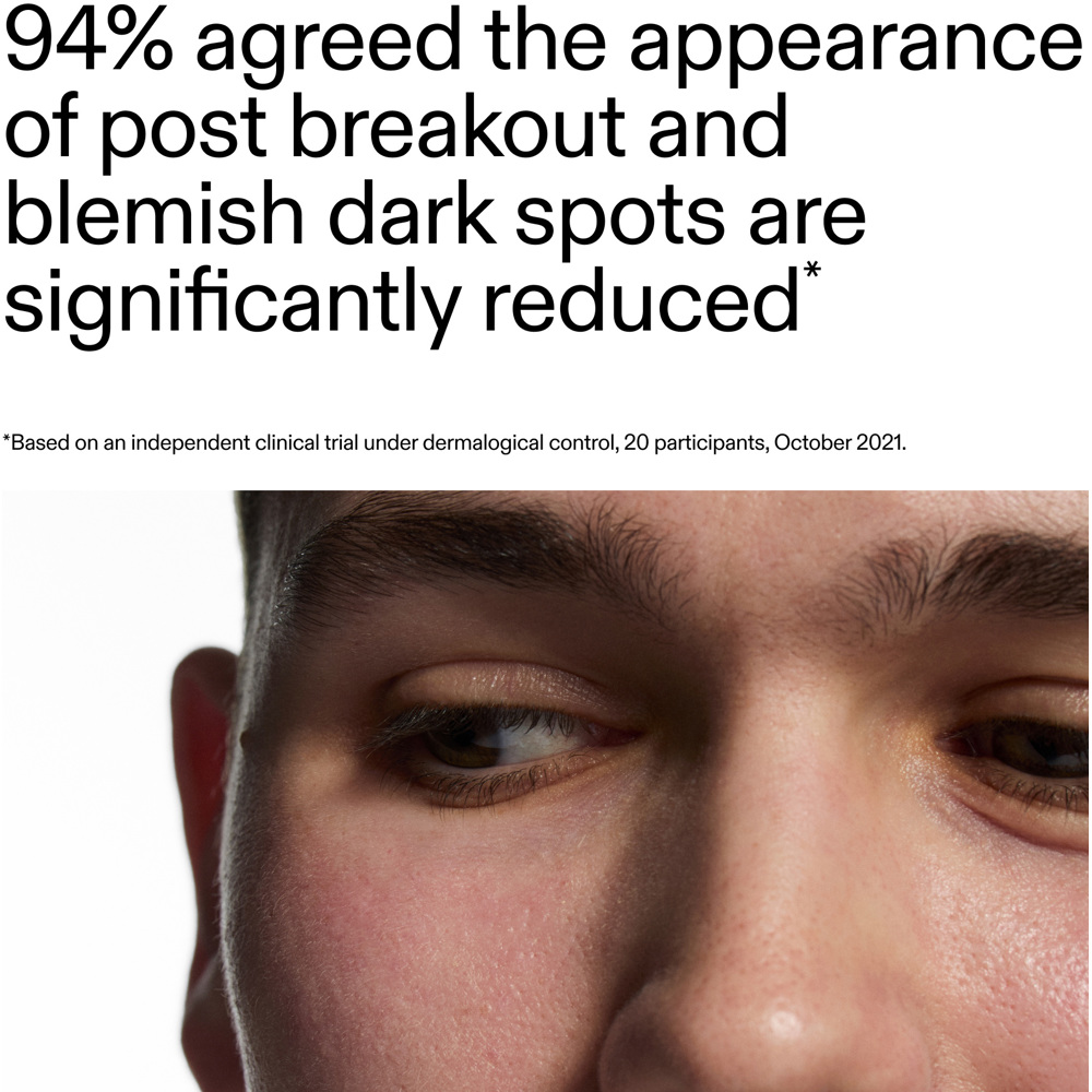 Mandelic Acid Treatment, 15ml