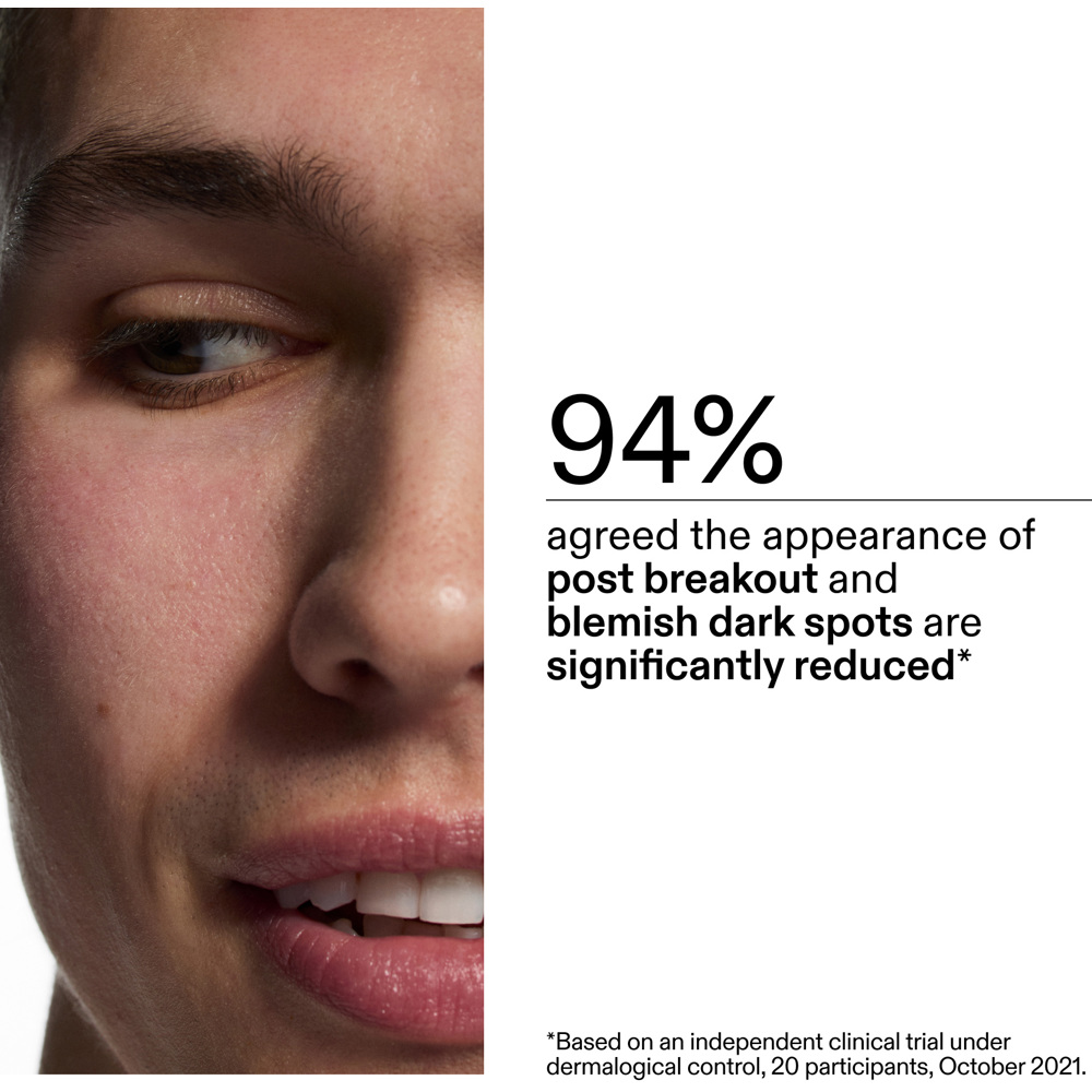 Mandelic Acid Treatment, 15ml