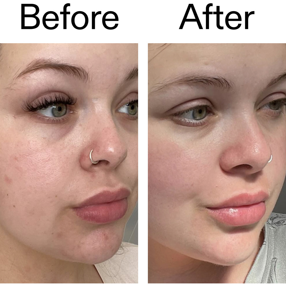 Omega Water Cream, 50ml