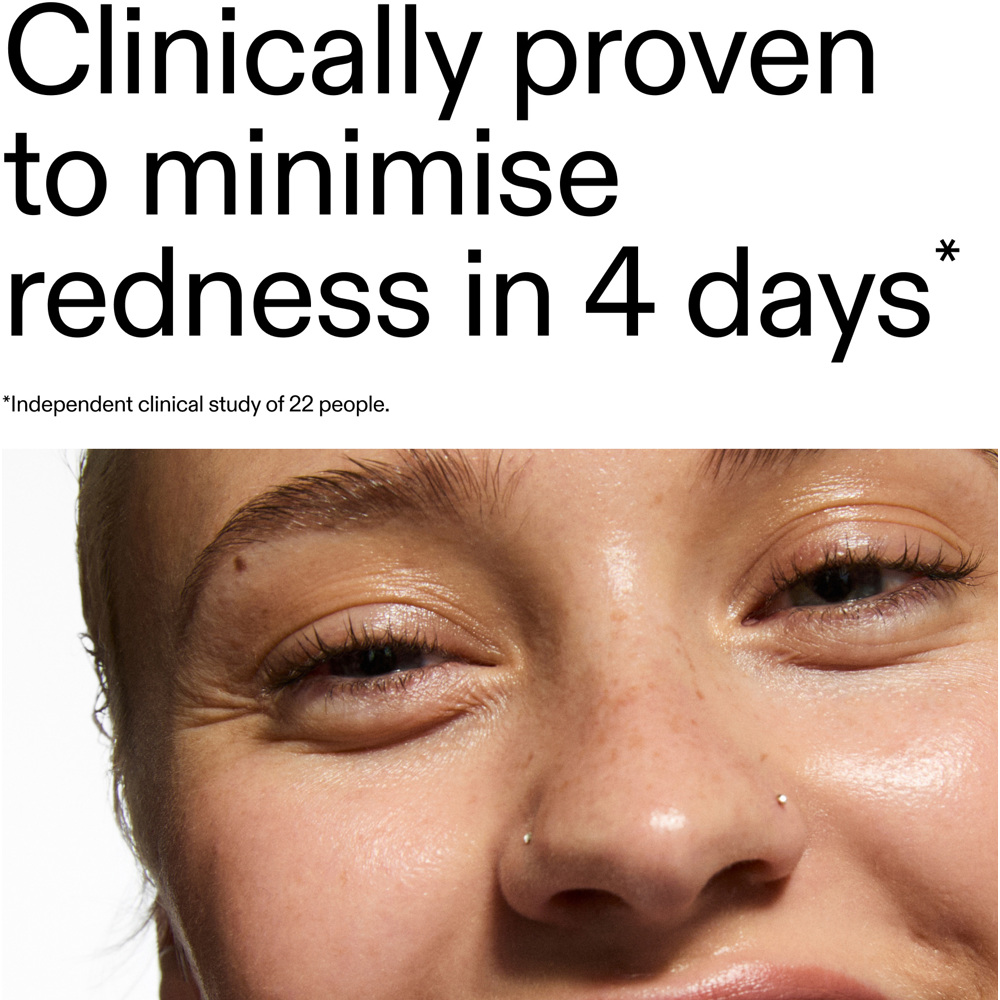 Azelaic Acid 10% Serum, 30ml