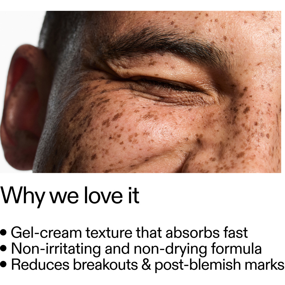 Blemish Clearing Moisturizer 2% Novoretin, 50ml