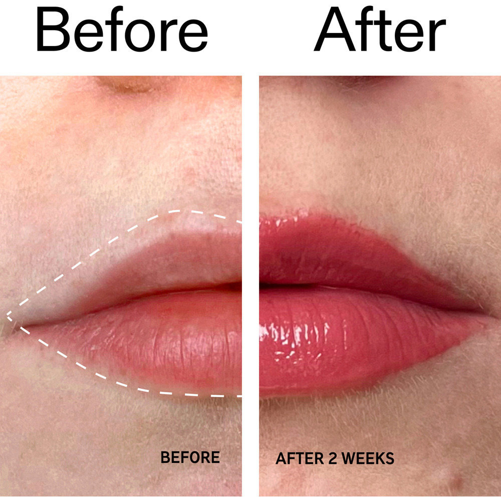 Tripeptide Plumping Lip Balm, 10ml