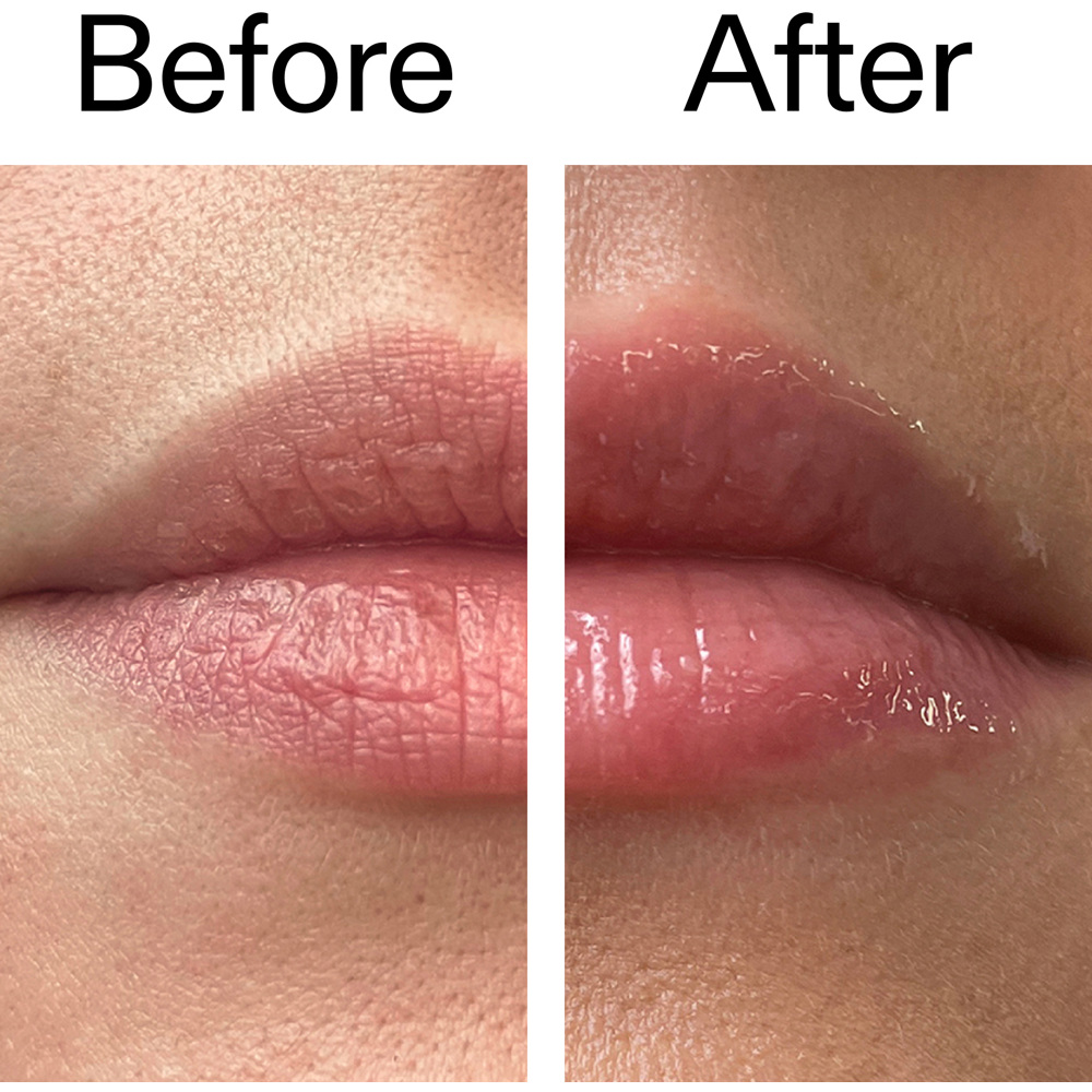 Tripeptide Plumping Lip Balm, 10ml