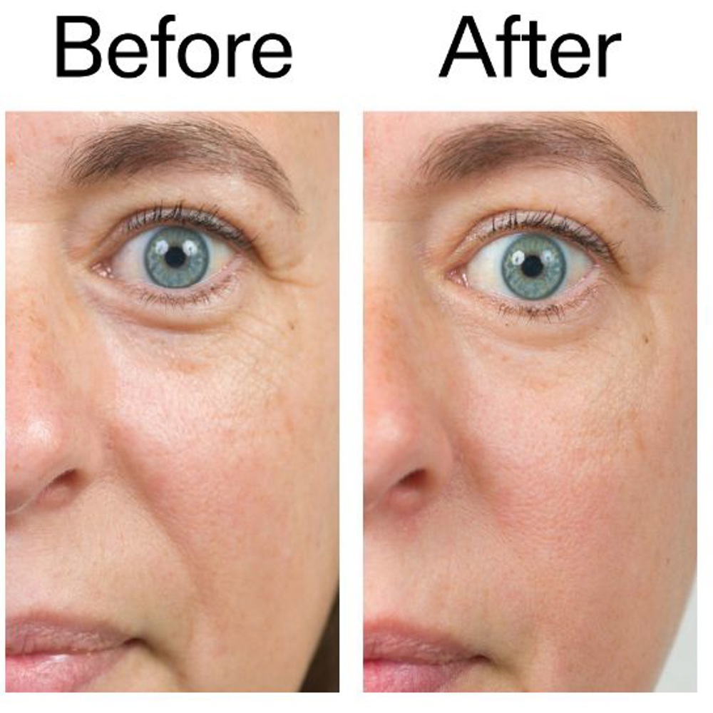 Bio-Active Ceramide Repairing and Plumping Moisturizer, 50ml