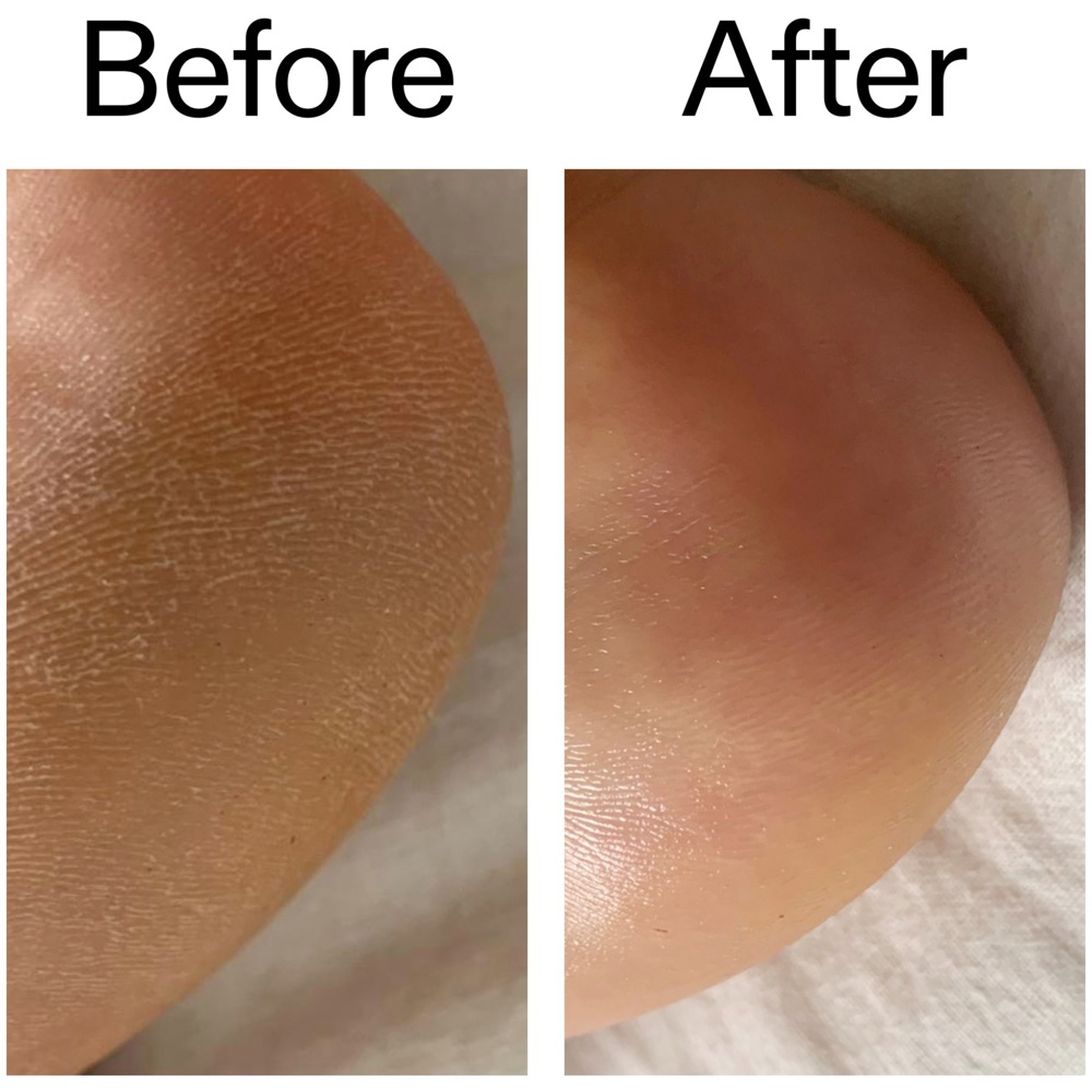 Glycolic Acid Exfoliating Body Stick, 45g