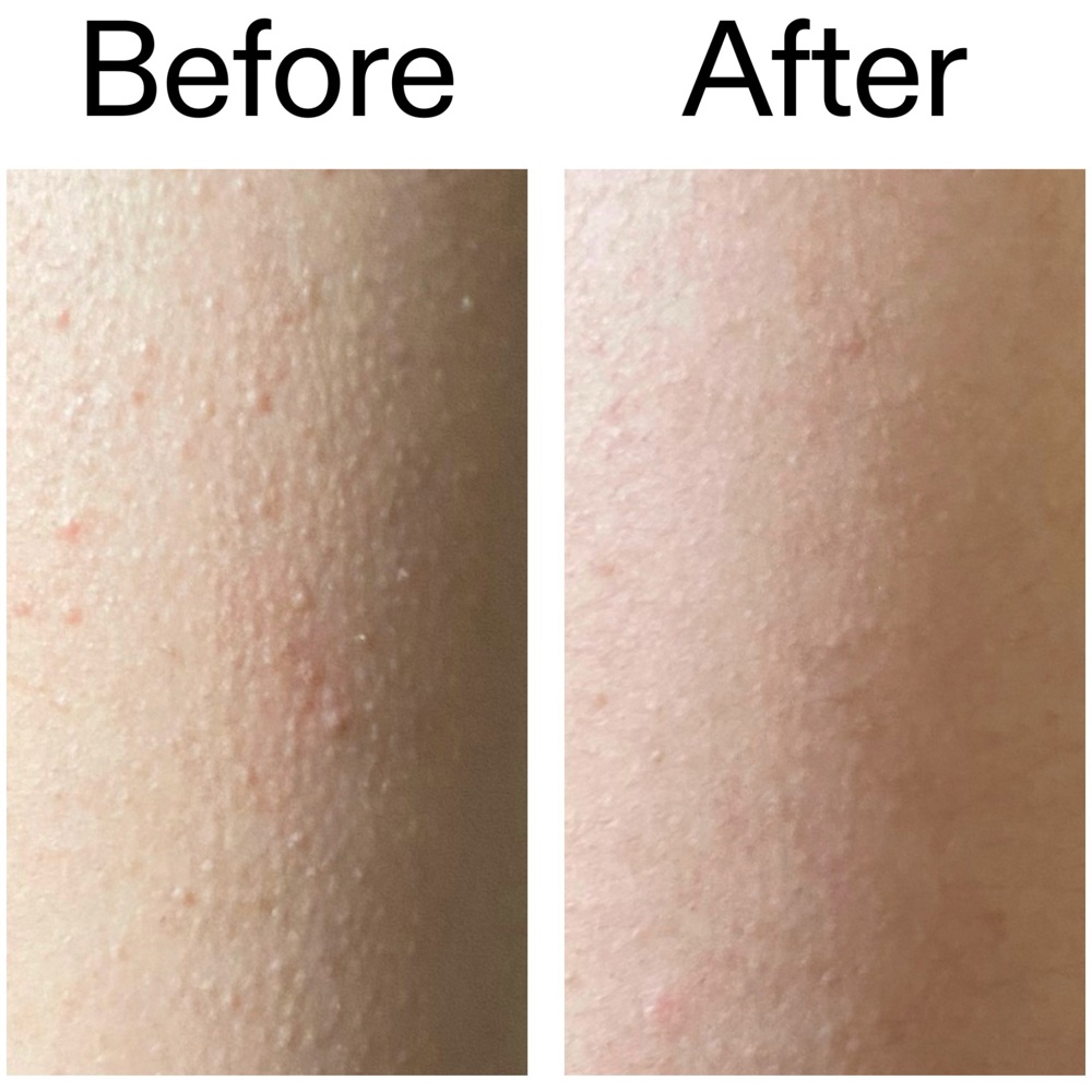 Glycolic Acid Exfoliating Body Stick, 45g