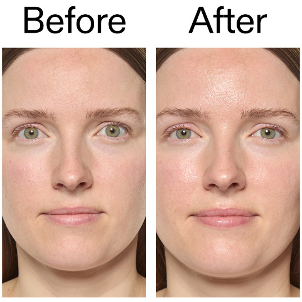 Exosome Hydro-Glow Complex, 30ml