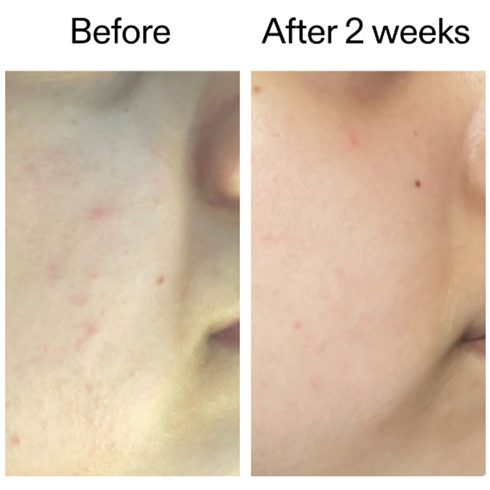 360 Skin Clearing Serum, 30ml