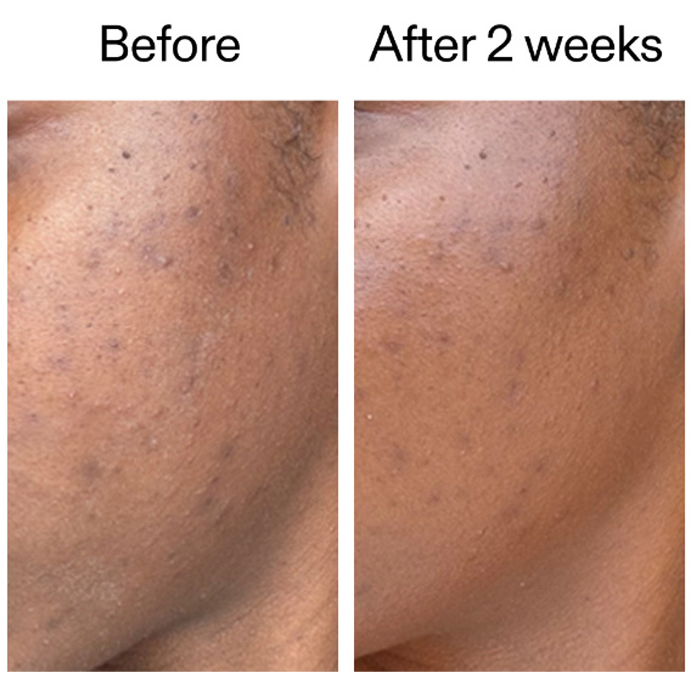 360 Skin Clearing Serum, 30ml