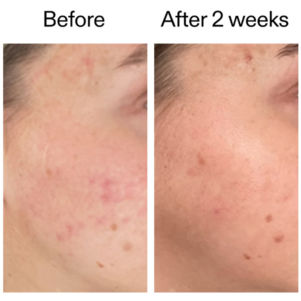 360 Skin Clearing Serum, 30ml