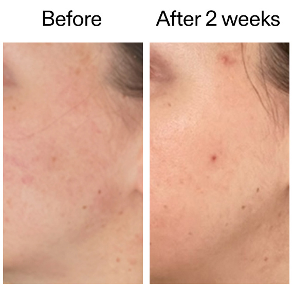 360 Skin Clearing Serum, 30ml