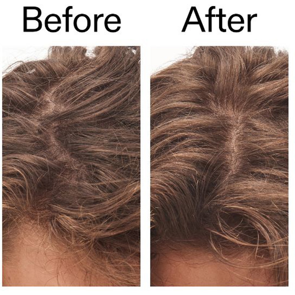 Glycolic Acid Exfoliating Scalp Scrub, 150ml