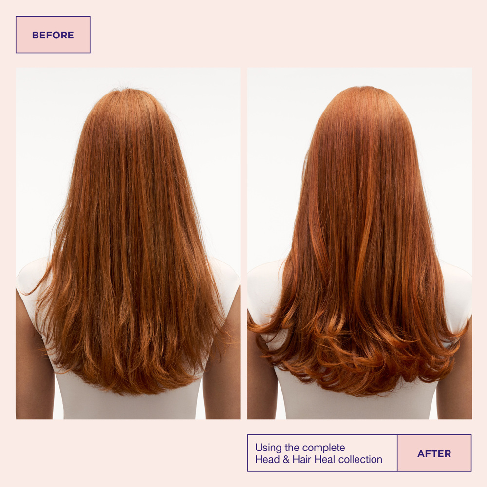 Head & Hair Heal Conditioner