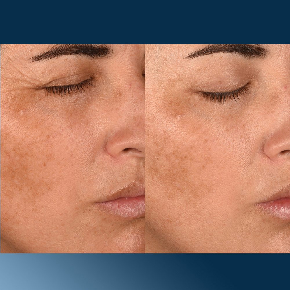 Pro-Collagen Banking Water Cream, 50ml