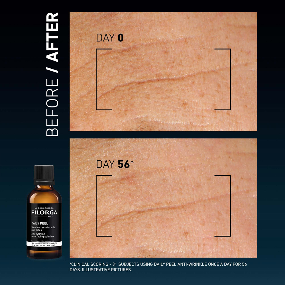 Daily Peel Anti-Wrinkle Resurfacing Solution, 50ml