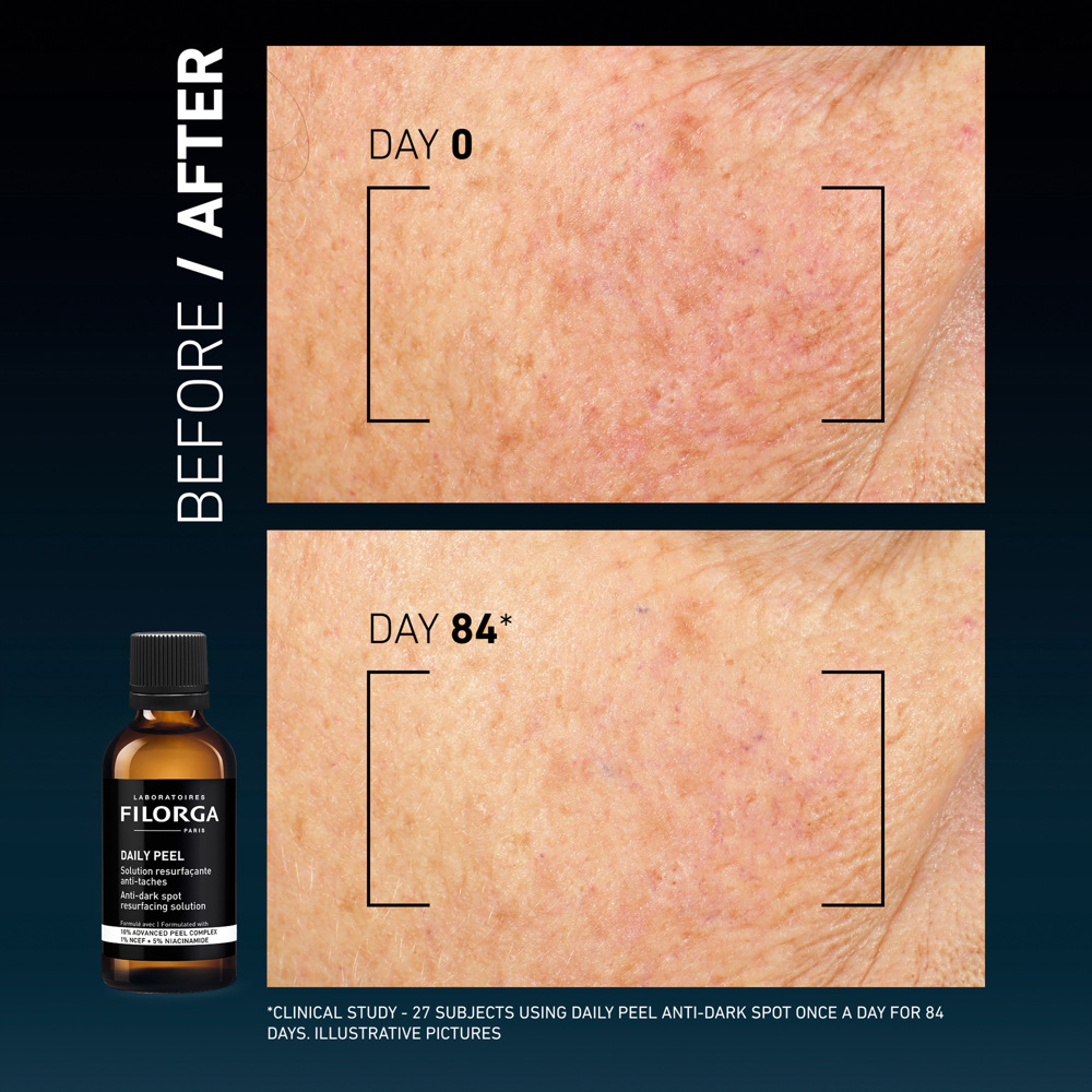 Daily Peel Anti-Dark Spot Resurfacing Solution, 50ml