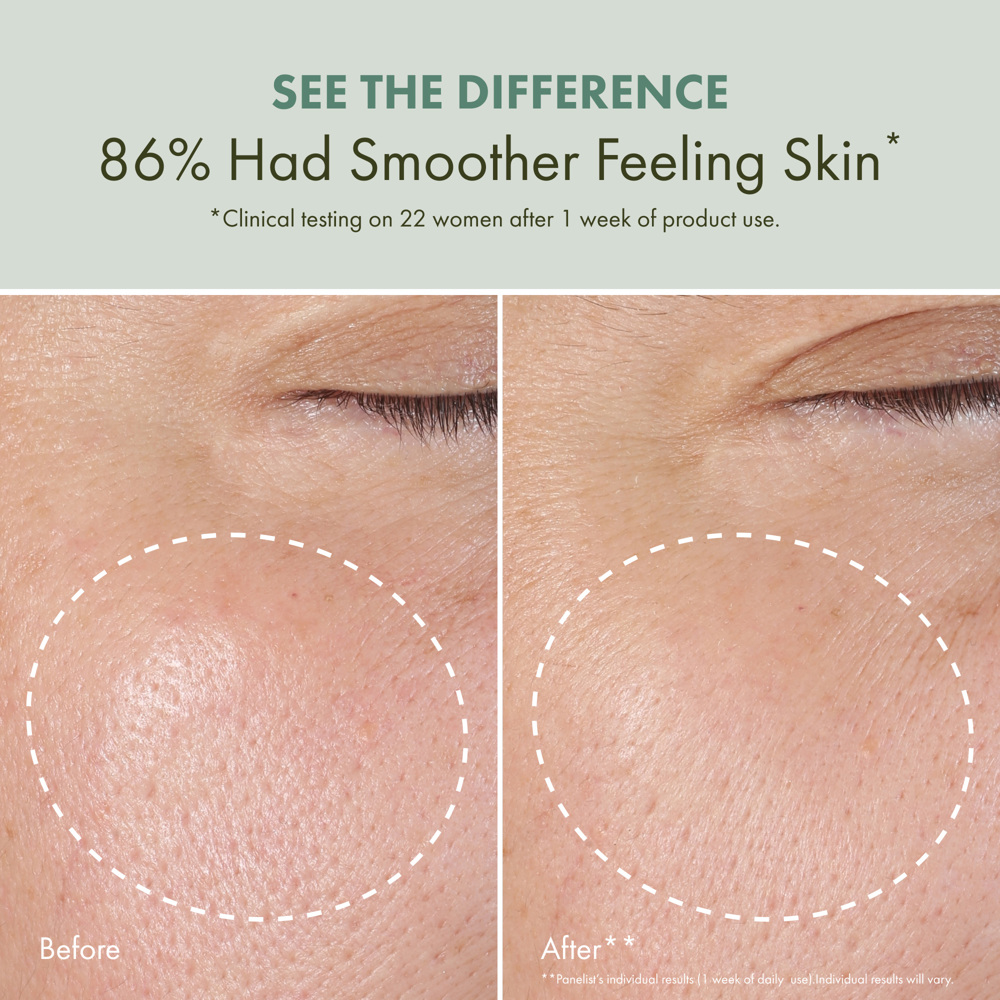 Checks and Balances™ Daily Exfoliating Toner, 150ml