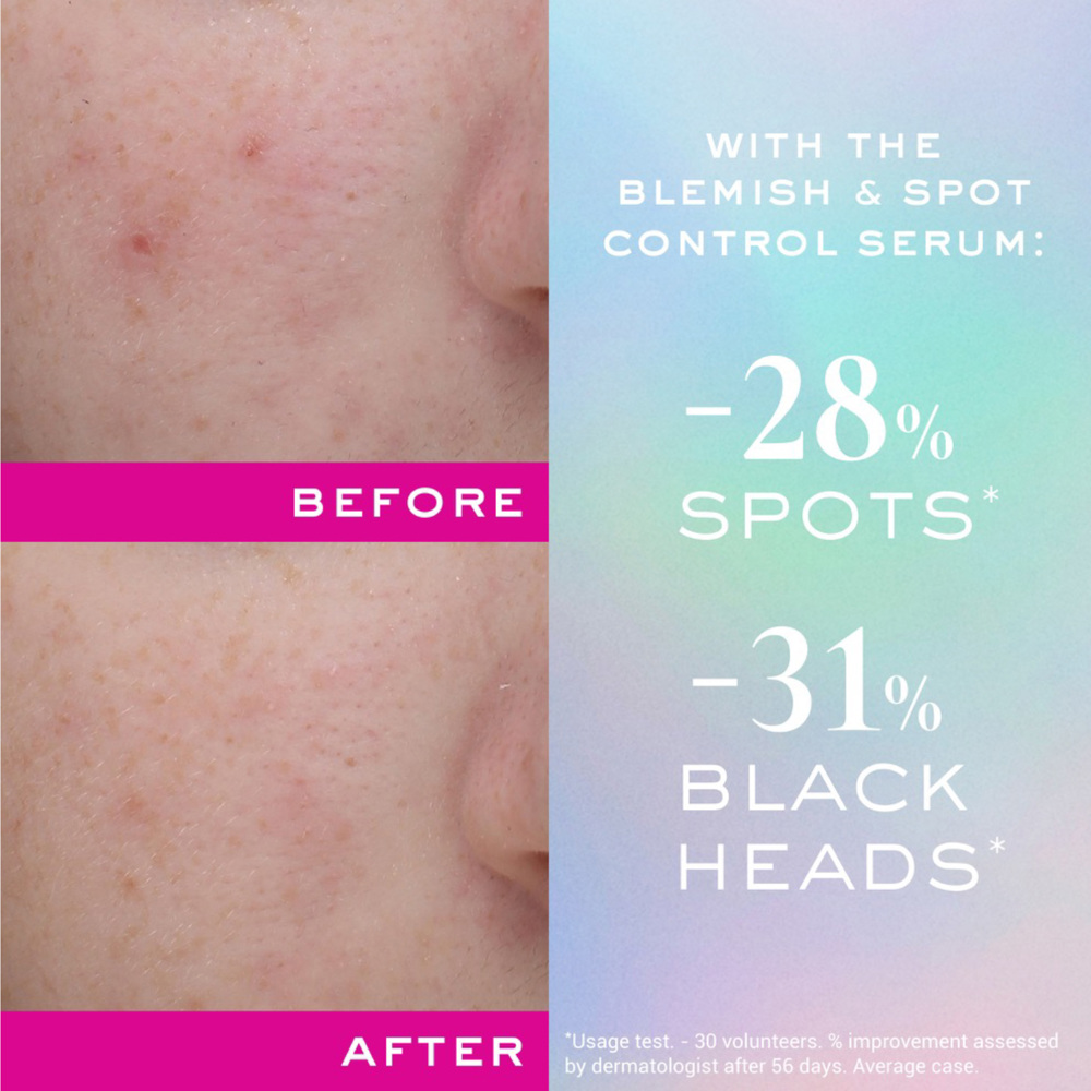 Zinc Power Blemish and Spot Control Serum, 30ml