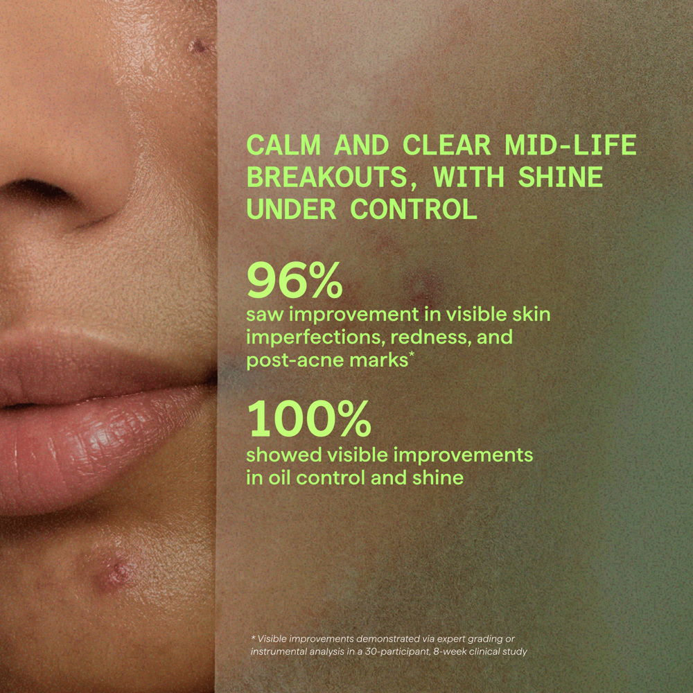 Biome-Balancing Calm + Recover Cream, 50ml