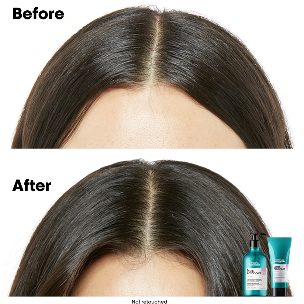 Scalp Advanced Anti-Discomfort Treatment, 200ml