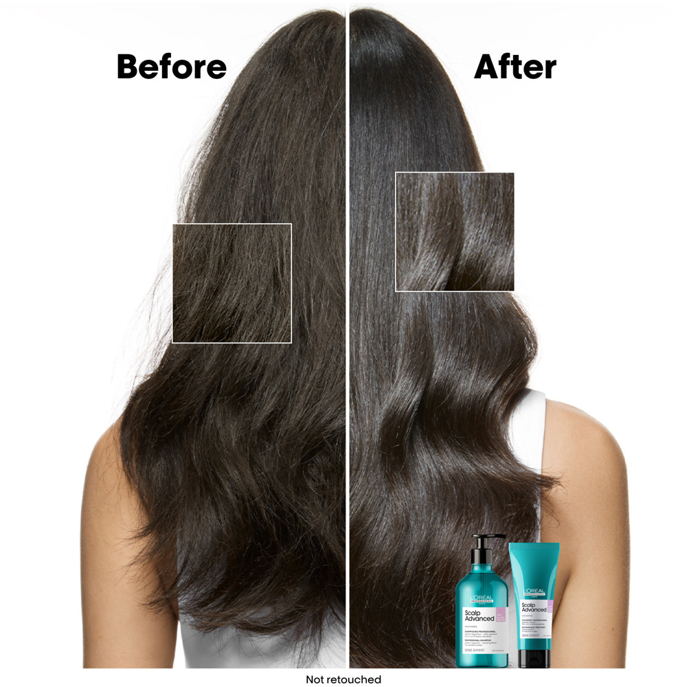 Scalp Advanced Anti-Discomfort Treatment, 200ml