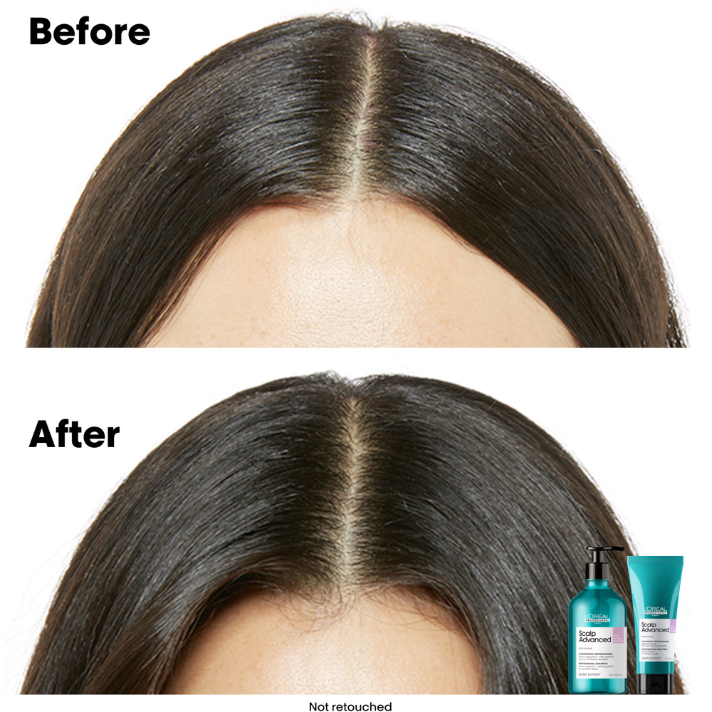 Scalp Advanced Anti-Discomfort Shampoo