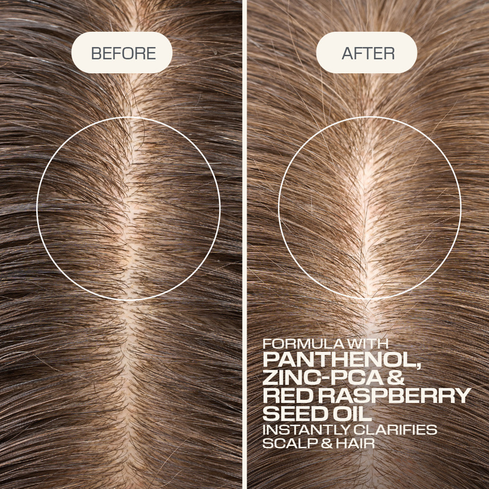 Dualsenses Scalp Specialist Clarifying Shampoo