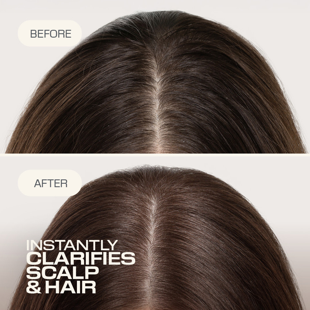Dualsenses Scalp Specialist Clarifying Shampoo