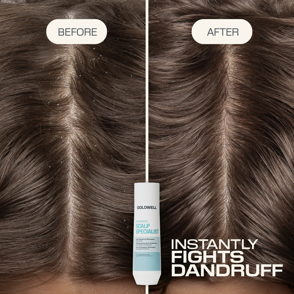 Dualsenses Scalp Specialist Anti-Dandruff Shampoo