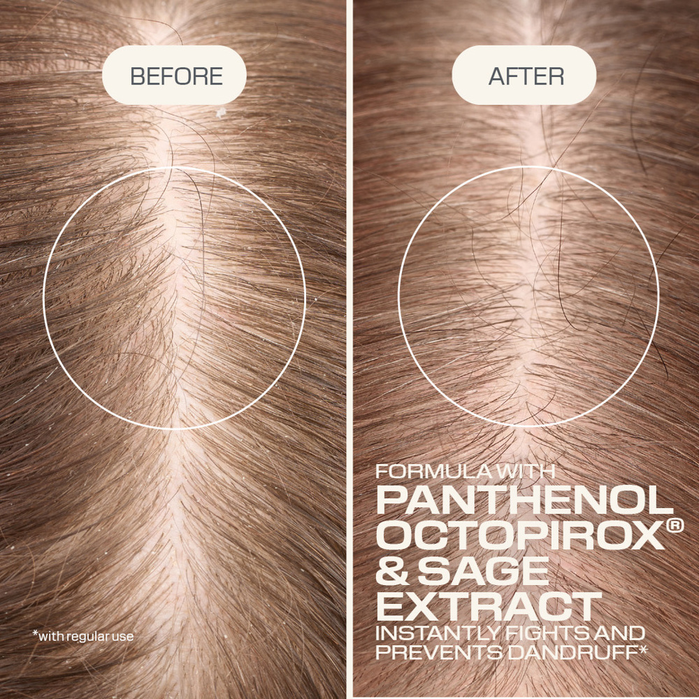 Dualsenses Scalp Specialist Anti-Dandruff Shampoo