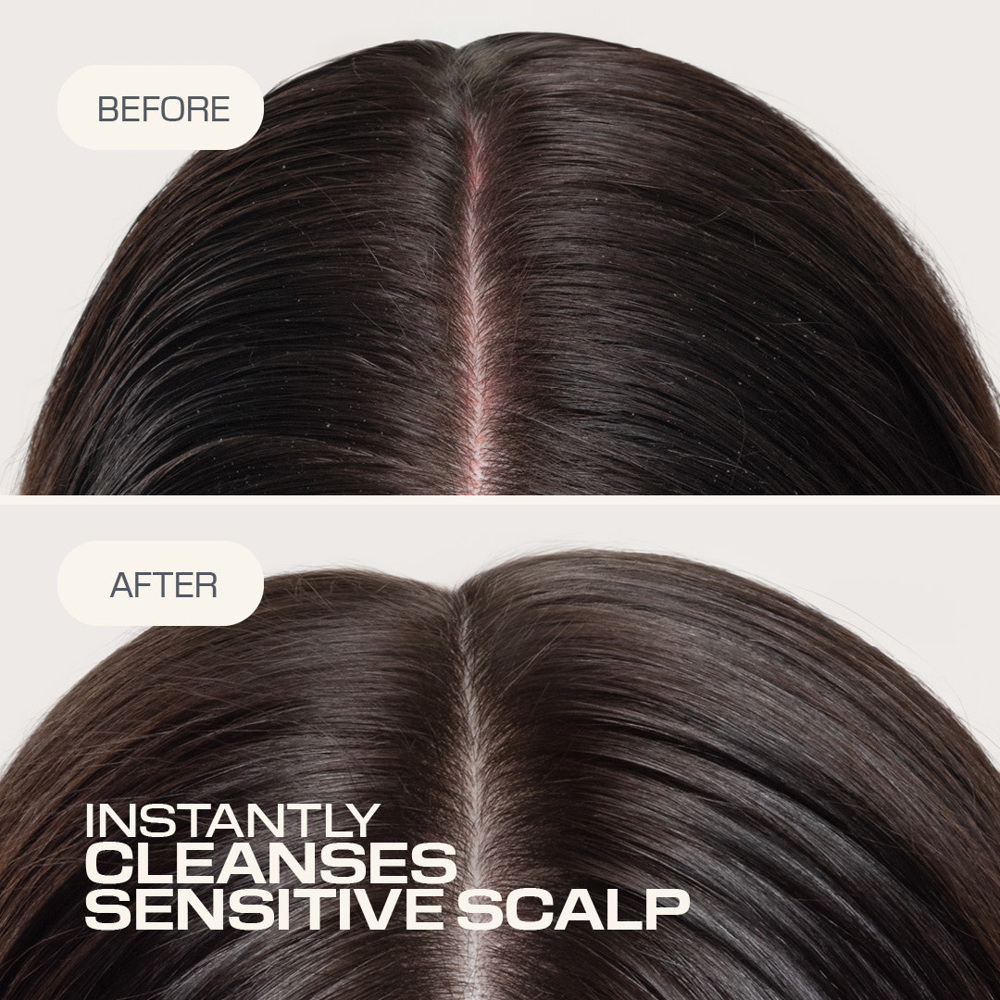 Dualsenses Scalp Specialist Sensitive Foam Shampoo