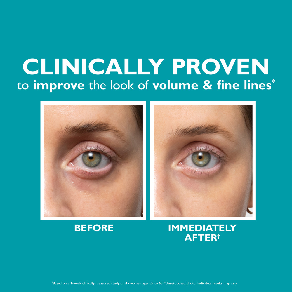 Peptide Skinjection™ Fill + Fix Under-Eye Cream, 15ml