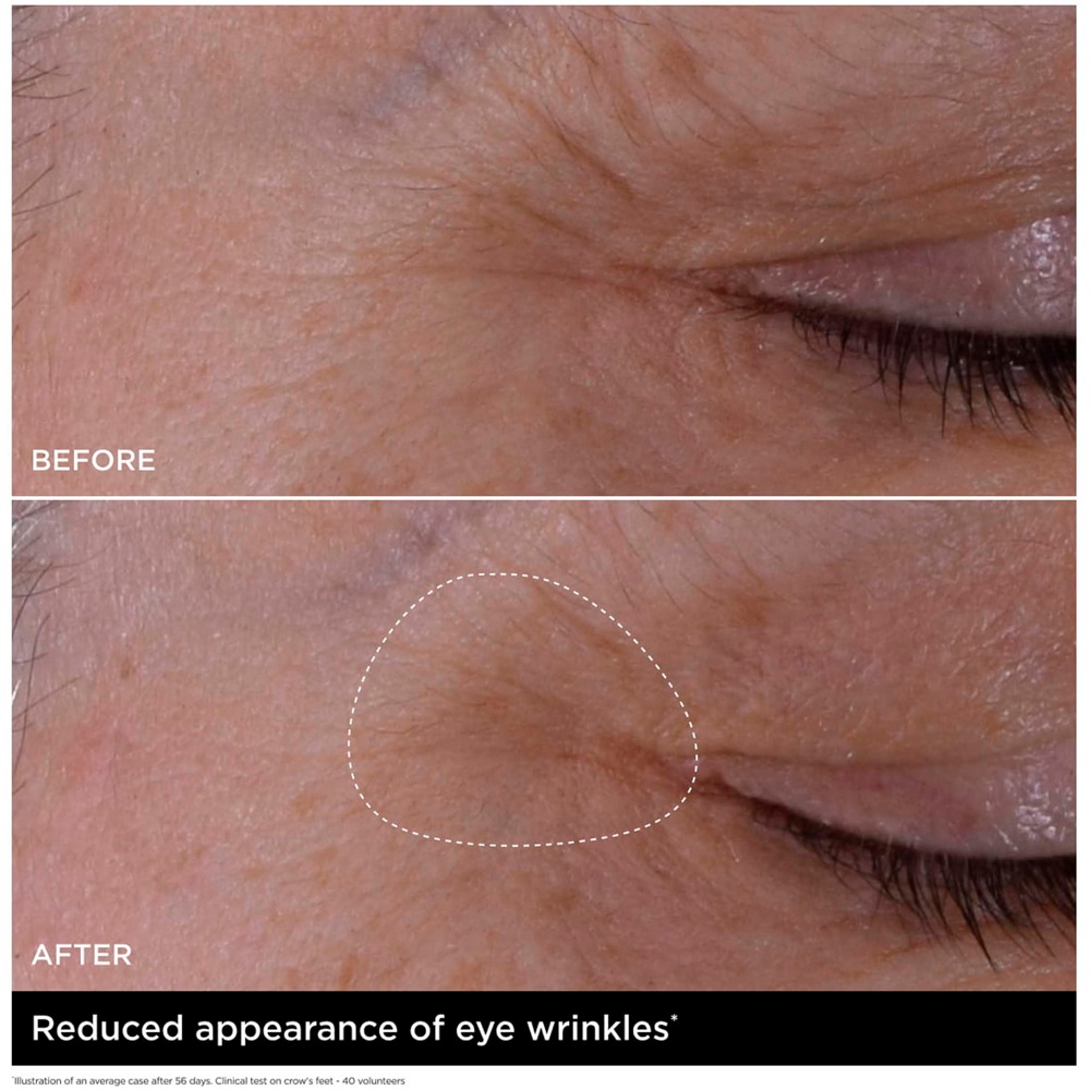Double Serum Eye