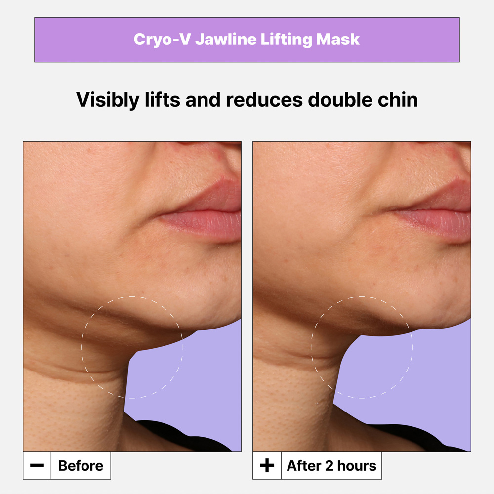 Cryo V-Sculpt Jawline Lifting Mask, 8g