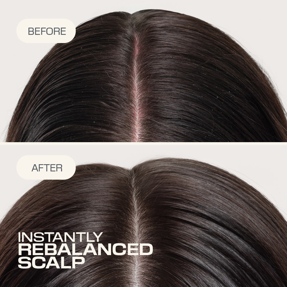 Dualsenses Scalp Specialist Rebalance & Hydrate Fluid